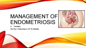 MANAGEMENT OF ENDOMETRIOSIS A Tarafdari Ob Gyn Fellowship