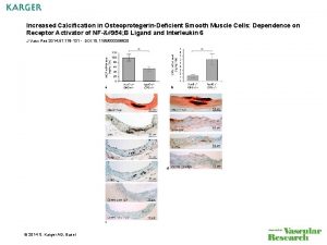 Increased Calcification in OsteoprotegerinDeficient Smooth Muscle Cells Dependence