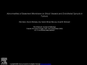 Abnormalities of Basement Membrane on Blood Vessels and