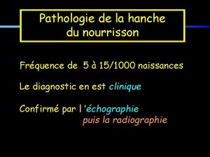 Pathologie de la hanche du nourrisson Frquence de