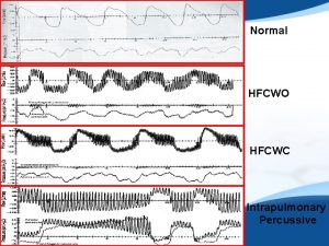 Normal HFCWO HFCWC Intrapulmonary Percussive Case Report 714