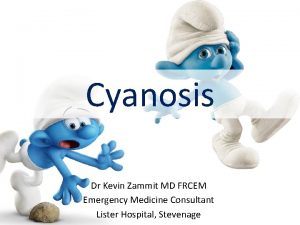 Cyanosis Dr Kevin Zammit MD FRCEM Emergency Medicine