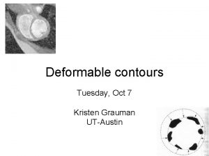 Deformable contours Tuesday Oct 7 Kristen Grauman UTAustin