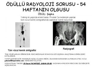 DLL RADYOLOJ SORUSU 54 HAFTANIN OLGUSU DL apka