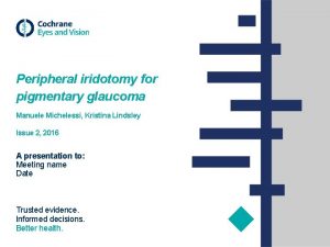 Peripheral iridotomy for pigmentary glaucoma Manuele Michelessi Kristina