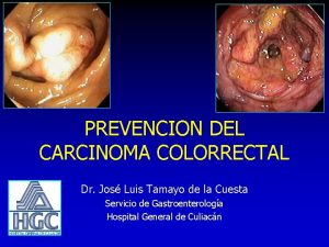 PREVENCION DEL CARCINOMA COLORRECTAL Dr Jos Luis Tamayo