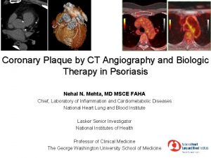 Coronary Plaque by CT Angiography and Biologic Therapy