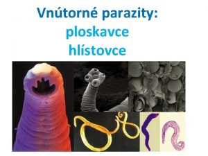 Vntorn parazity ploskavce hlstovce Mil iestaci Dnes sa