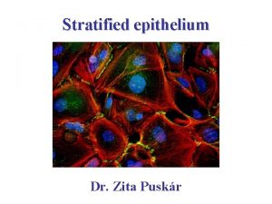 Stratified epithelium Dr Zita Puskr Stratified epithelium Nonkeratinized