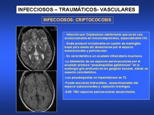 INFECCIOSOS TRAUMTICOS VASCULARES INFECCIOSOS CRIPTOCOCOSIS Infeccin por Criptococco