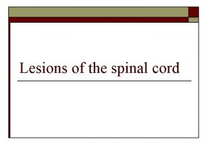 Lesions of the spinal cord Spinal cord lamination