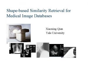 Shapebased Similarity Retrieval for Medical Image Databases Xiaoning