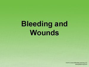 Bleeding and Wounds External Bleeding 1 of 2