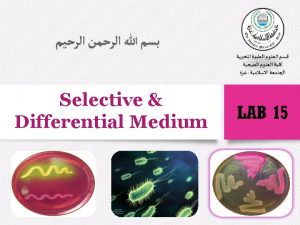 Selective Differential Medium Introduction v In addition to