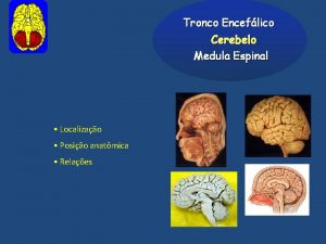 Tronco Enceflico Cerebelo Medula Espinal Localizao Posio anatmica