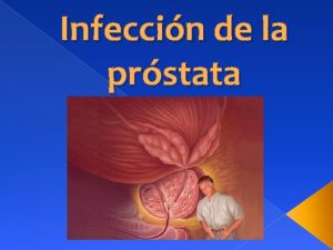 Infeccin de la prstata Prostatitis bacteriana aguda Inflamacin