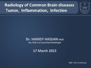 Radiology of Common Brain diseases Tumor Inflammation Infection