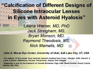 Calcification of Different Designs of Silicone Intraocular Lenses