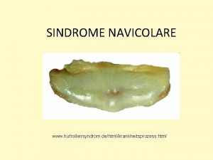 SINDROME NAVICOLARE www hufrollensyndrom dehtmlkrankheitsprozess html Sindrome navicolare