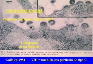 VIH DE 1983 EN 1983 Partculas de tipoC