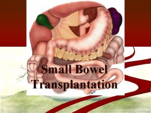 Small Bowel Transplantation Intestinal Transplantation n Indications include