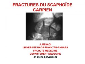 FRACTURES DU SCAPHODE CARPIEN A MENADI UNIVERSITE BADJI