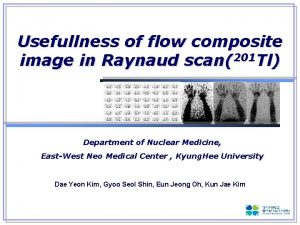 Usefullness of flow composite image in Raynaud scan201