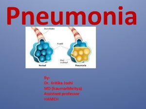 Pneumonia By Dr Kritika Joshi MD kaumarbhritya Assistant