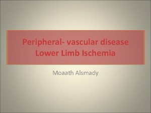 Peripheral vascular disease Lower Limb Ischemia Moaath Alsmady