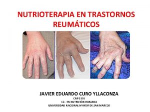 NUTRIOTERAPIA EN TRASTORNOS REUMTICOS JAVIER EDUARDO CURO YLLACONZA