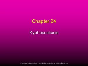 Chapter 24 Kyphoscoliosis Mosby items and derived items