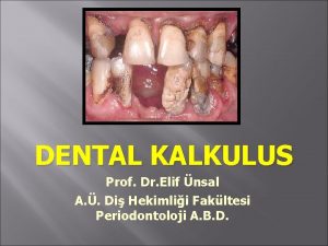 DENTAL KALKULUS Prof Dr Elif nsal A Di