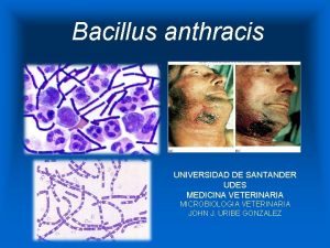 Bacillus anthracis UNIVERSIDAD DE SANTANDER UDES MEDICINA VETERINARIA