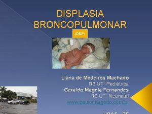 DISPLASIA BRONCOPULMONAR DBP Liana de Medeiros Machado R