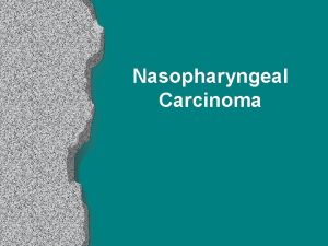 Nasopharyngeal Carcinoma Introduction l l l Rare in