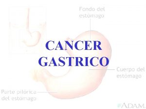 CANCER GASTRICO ANATOMIA DEL ESTOMAGO CAPA SUBMUCOSA CAPA