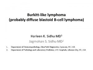 Burkittlike lymphoma probably diffuse blastoid Bcell lymphoma Harleen