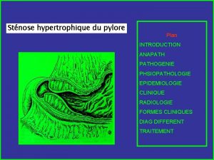 Stnose hypertrophique du pylore Plan INTRODUCTION ANAPATHOGENIE PHSIOPATHOLOGIE
