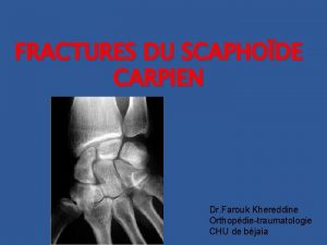 FRACTURES DU SCAPHODE CARPIEN Dr Farouk Khereddine Orthopdietraumatologie