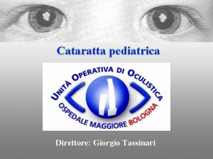 Cataratta pediatrica Direttore Giorgio Tassinari Tecniche chirurgiche Lestrazione