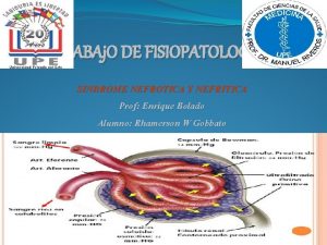 TRABAj O DE FISIOPATOLOGIA SINDROME NEFROTICA Y NEFRITICA