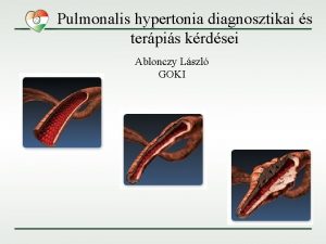 Pulmonalis hypertonia diagnosztikai s terpis krdsei Ablonczy Lszl