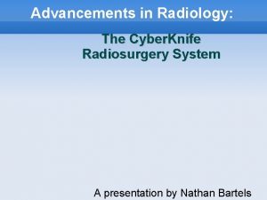Advancements in Radiology The Cyber Knife Radiosurgery System