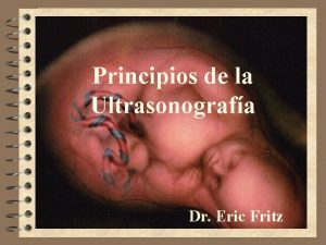 Principios de la Ultrasonografa Dr Eric Fritz Ecografa