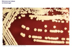 Micrococcus luteus on blood agar A microbiologists view