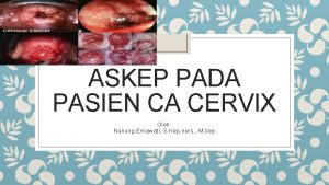 ASKEP PADA PASIEN CA CERVIX Oleh Nunung Ernawati