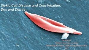 Sickle Cell Disease and Cold Weather Dos and