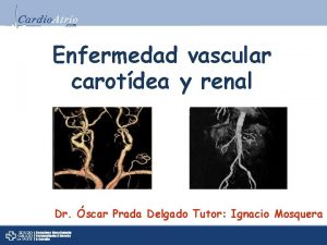 Enfermedad vascular carotdea y renal Dr scar Prada