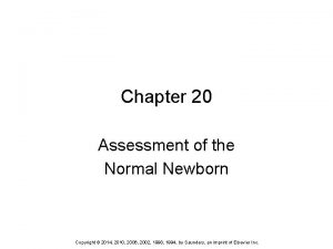 Chapter 20 Assessment of the Normal Newborn Copyright