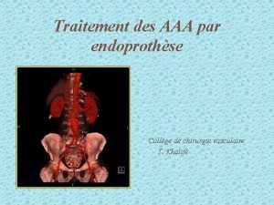 Traitement des AAA par endoprothse Collge de chirurgie